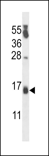 WB - PIPPIN Antibody (Center) AP14318C